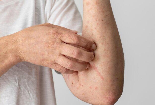 7 dấu hiệu gan quá tải nhưng dễ bị nhầm với “mệt thông thường”