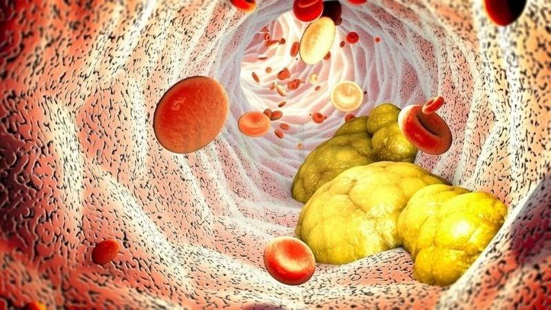 Chuyển hóa kém: Lý do khiến bạn dễ mệt, dễ tích mỡ dù ăn không nhiều