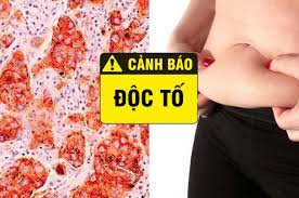 Làm sạch cơ thể từ bên trong bằng thảo dược – Giải pháp khỏe sâu và bền vững